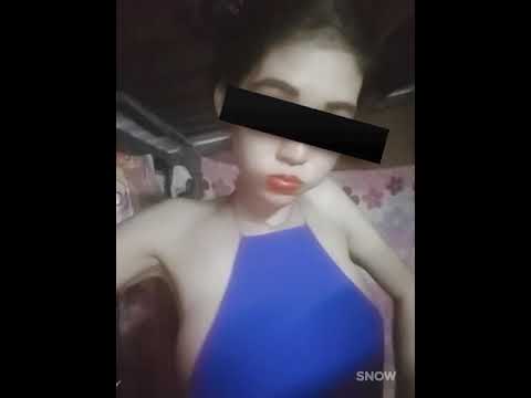 เต้านมซิลิโคนชุดชั้นใน ไม่ว่าจะเป็นการปลูกถ่ายจะรู้สึกในหน้าอก