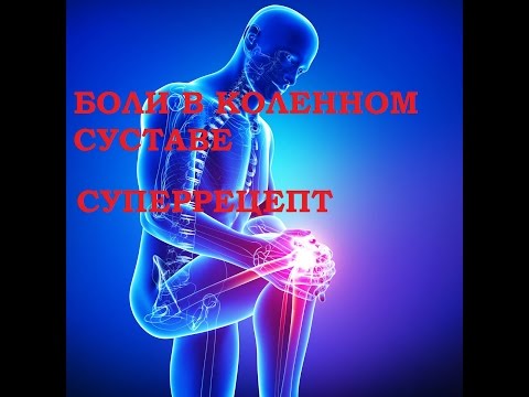 Полиартроз плечевого сустава симптомы и лечение Реабилитация повреждения связок коленного сустава