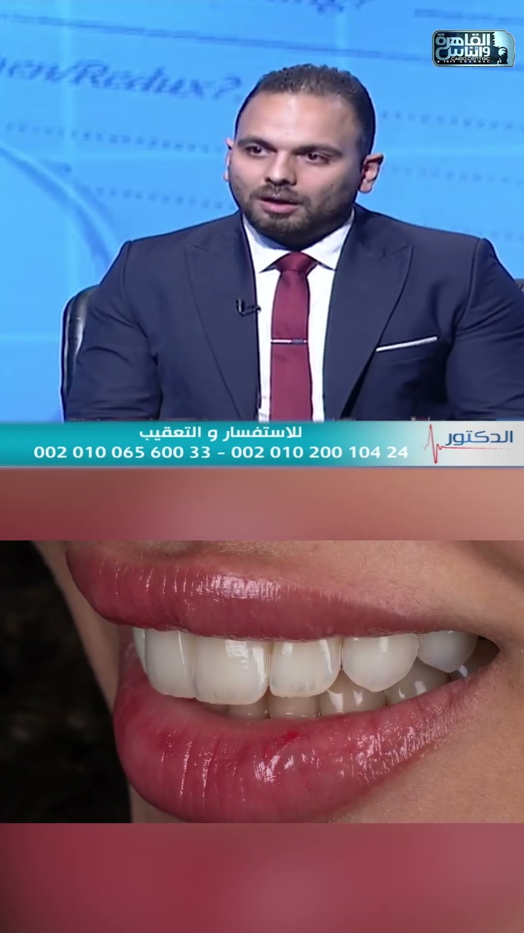 مقابلة — ابتسامة هوليوود