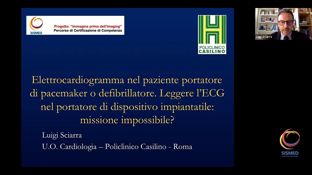 L. Sciarra - Elettrocardiogramma nel paziente portatore di pacemaker o defibrillatore.