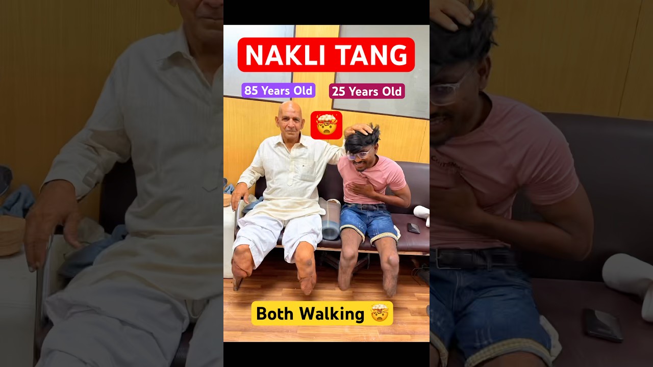 Ossur Carbon Foot | Proflex XC | Endolite India | Ottobock India | Instalimb | #ossur #ottobock