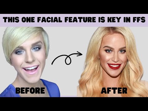 Gigi Gorgeous's FFS Surgeon Explains What Makes the Face Look Feminine