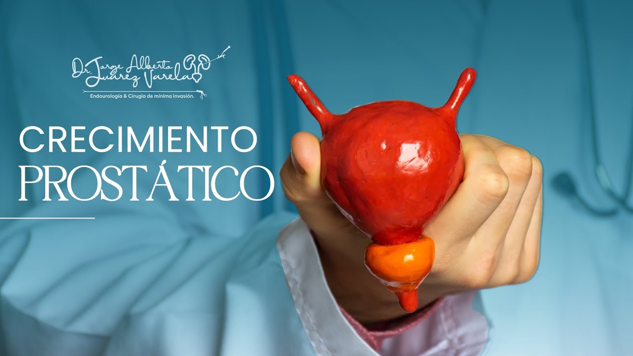 Jorge Alberto Juárez Varela-78