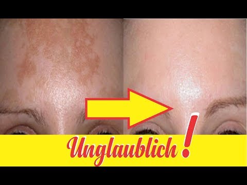 Was ist, wenn das entzündete Ellbogengelenk zu tun Schmerzen im unteren Rückenbereich auf der rechten Seite gibt