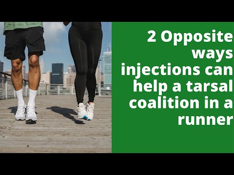 2 Opposite ways injections can help a tarsal coalition in a runner
