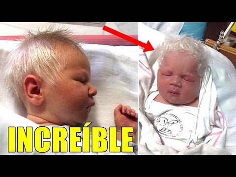 Niño nace con el pelo blanco,  cuando el médico cuenta la verdad la mamá se queda sin habla... Video