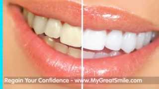 preview picture of video 'Invisalign West Springfield MA 413-241-3263'