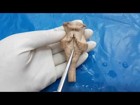 Fourth ventricle - Neuroanatomy