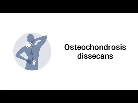 Augenschmerzen und Symptome von Gebärmutterhalskrebs Osteochondrose Dikrasin der zervikalen degenerative Scheibenerkrankung
