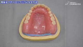 義歯のリライン法【日本補綴歯科学会教育用ビデオ】