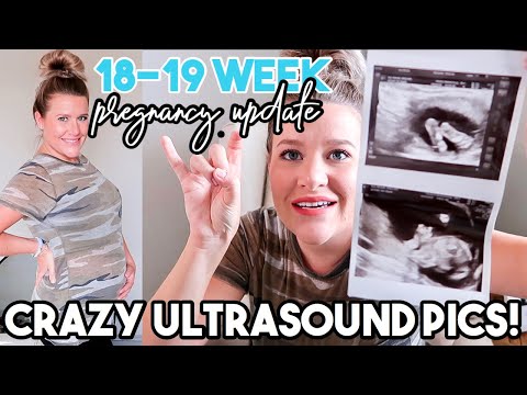 18-19 WEEK PREGNANCY UPDATE | FIRST BABY