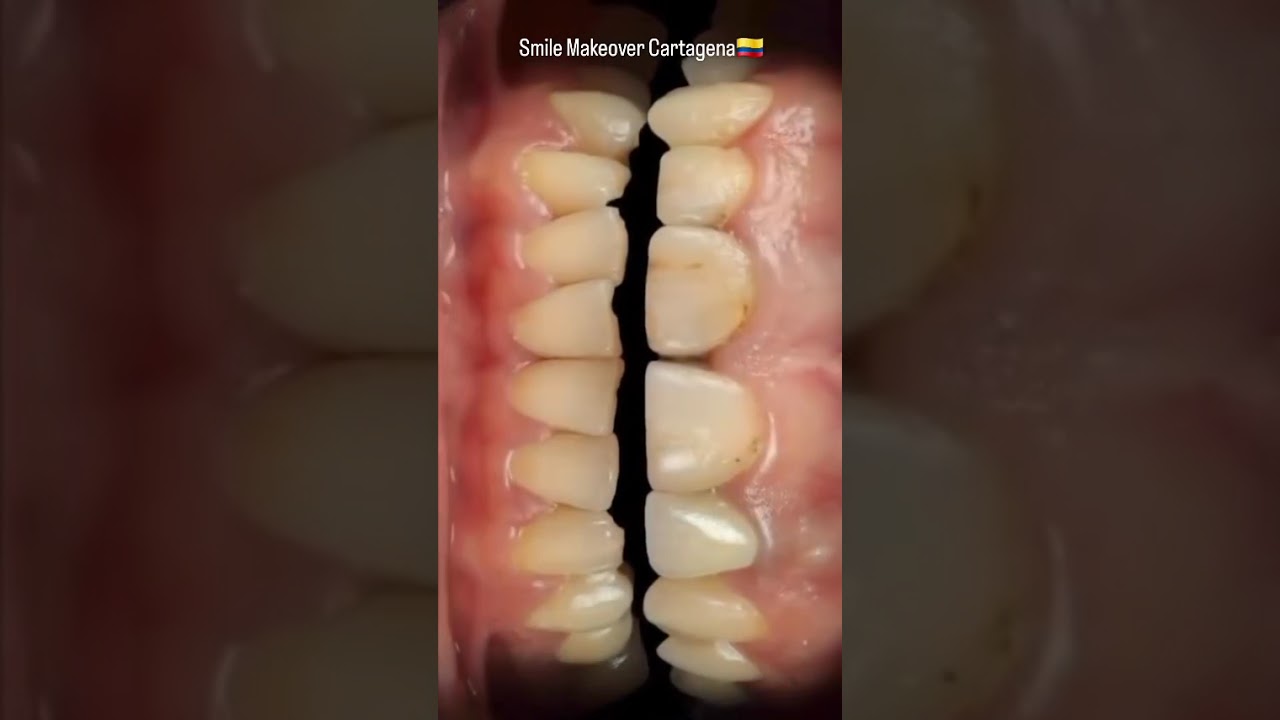 Fanny Valera Velásquez-143