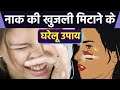 नाक में खुजली हो तो क्या करें नाक में ख�