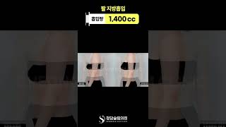 뼈팔, 일자팔 원한다면 주목🙋‍♀️