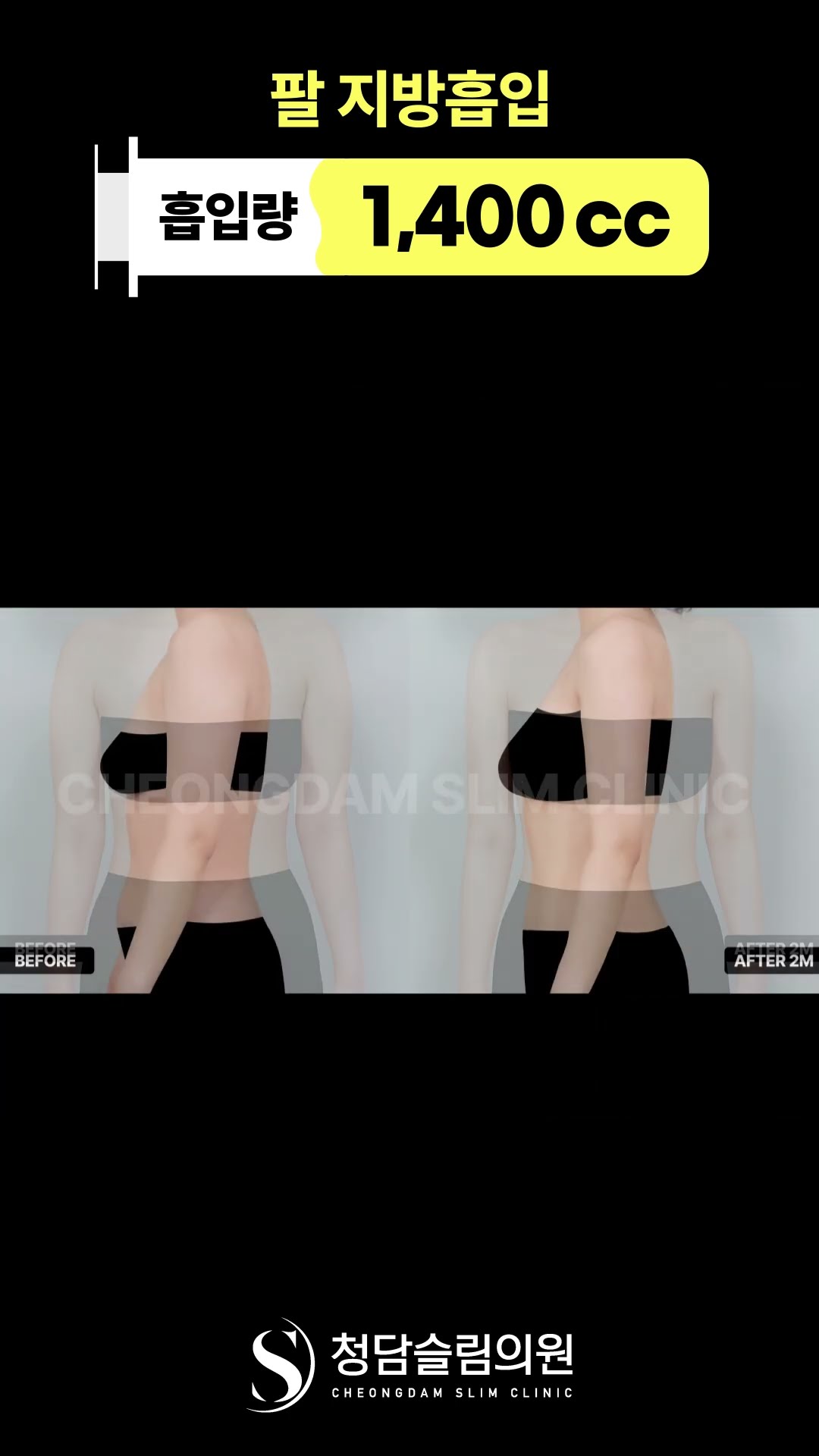 뼈팔, 일자팔 원한다면 주목🙋‍♀️