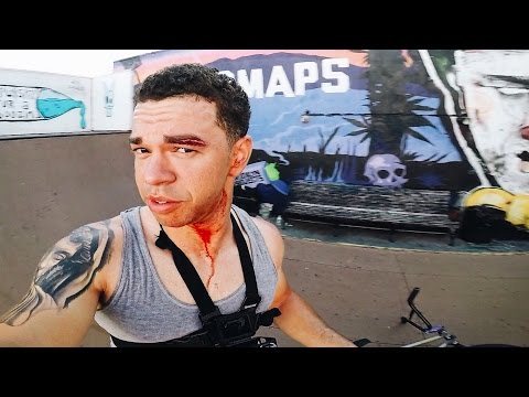 The Worst BMX Crash Of My Entire Life.. Video