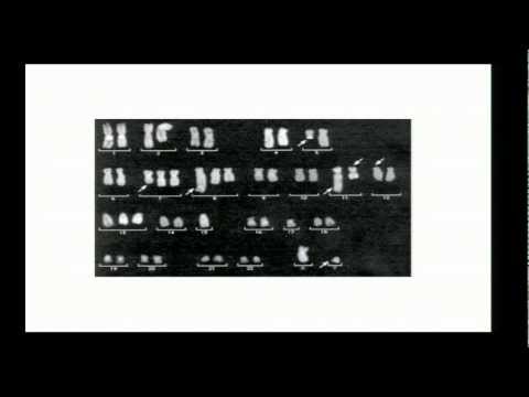 MPG Primer: Genome structural variation (2013)