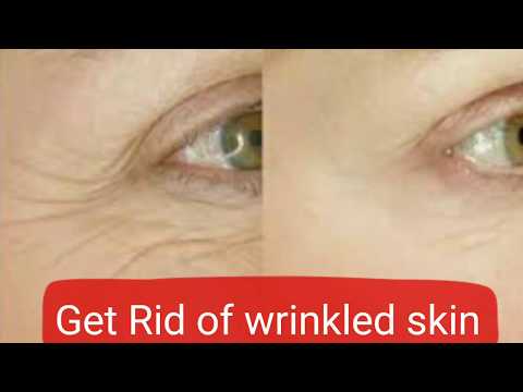 download lagu mp3 mp4 Flaxseed Oil For Wrinkles, download lagu Flaxseed Oil For Wrinkles gratis, unduh video klip Flaxseed Oil For Wrinkles