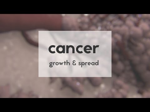 Cancer: growth & spread