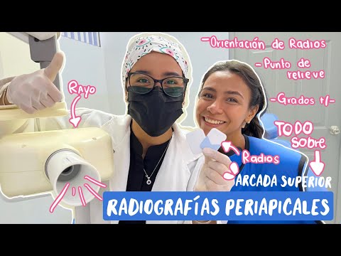 HOW TO TAKE PERIAPICAL X-RAYS? | upper arch