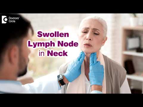 7 Causes of Swollen Lymph Node in neck | Enlarged lymph glands- Dr. Harihara Murthy| Doctors' Circle
