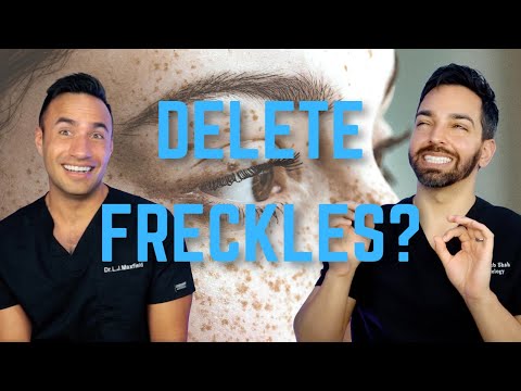 Freckles! Does SPF and Retinol Fade Them?