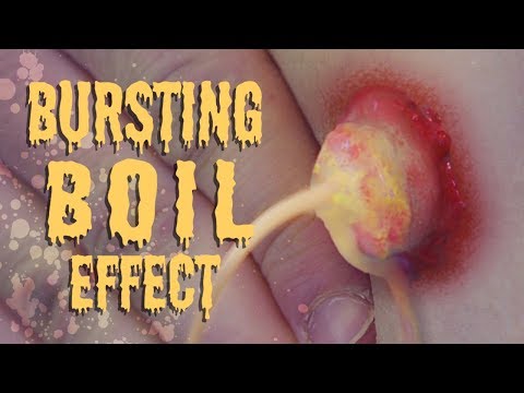 Bursting Boil: Practical Special Effects Tutorial Video