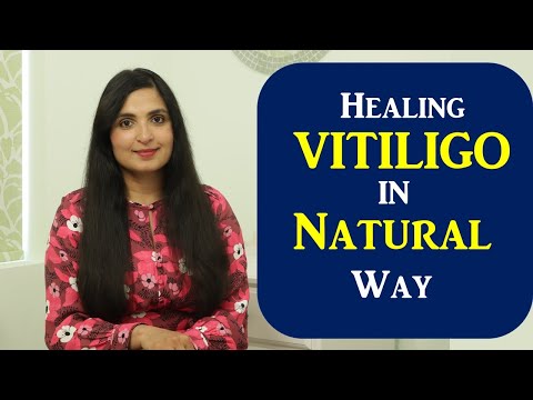 Healing Vitiligo Naturally | What Causes White Spots| How to Clear White Spots on the Skin Naturally
