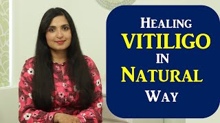 Healing Vitiligo Naturally | What Causes White Spots| How to Clear White Spots on the Skin Naturally