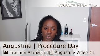 Hair Loss in Women | Hair Loss Cure | Procedure Day (Augustine)