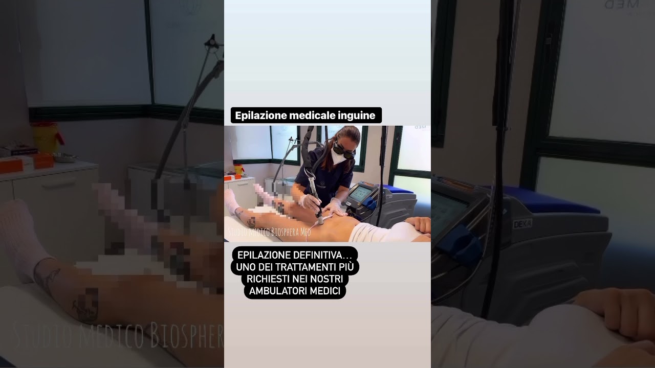 Epilazione definitiva laser Alessandrite