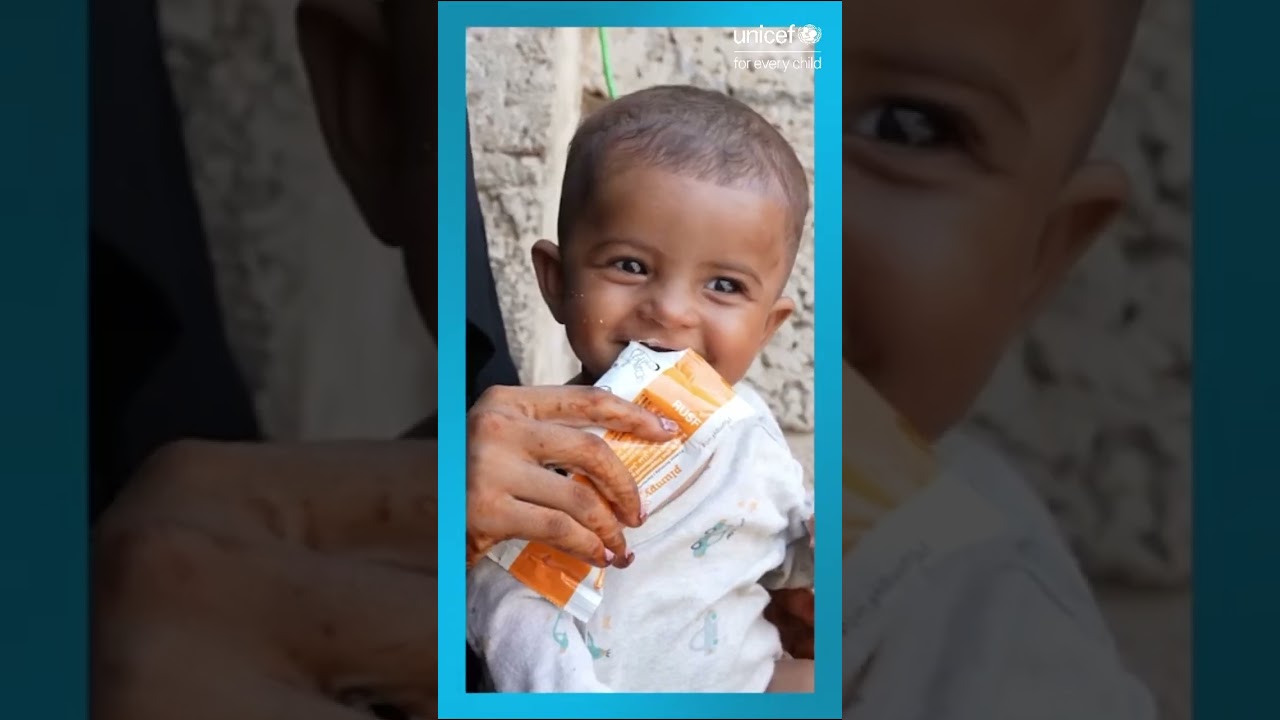 What is Ready-to-Use Therapeutic Food (RUTF) and how it can save a child's live.