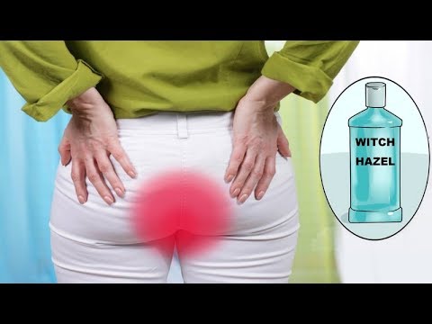 image-Is witch hazel good for deer?