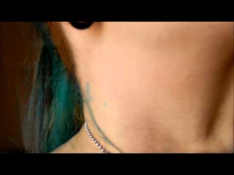 Trattamento della malattia degenerativa del disco cervicale della colonna cervicale Mal di schiena quando ci si alza in piedi e si arrende