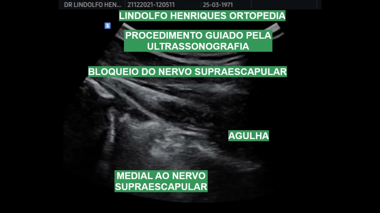 Lindolfo Henriques-14