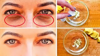 How to Get Rid of Black Circles Under Your Eyes