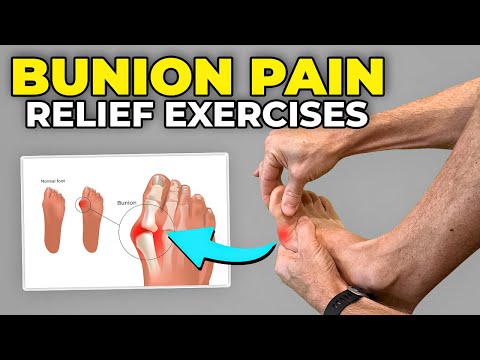 3 Bunion Pain Exercises