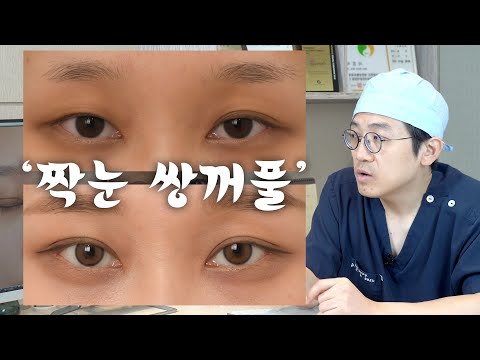 不对称 04