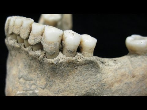 Dental calculus: ancient diets revealed