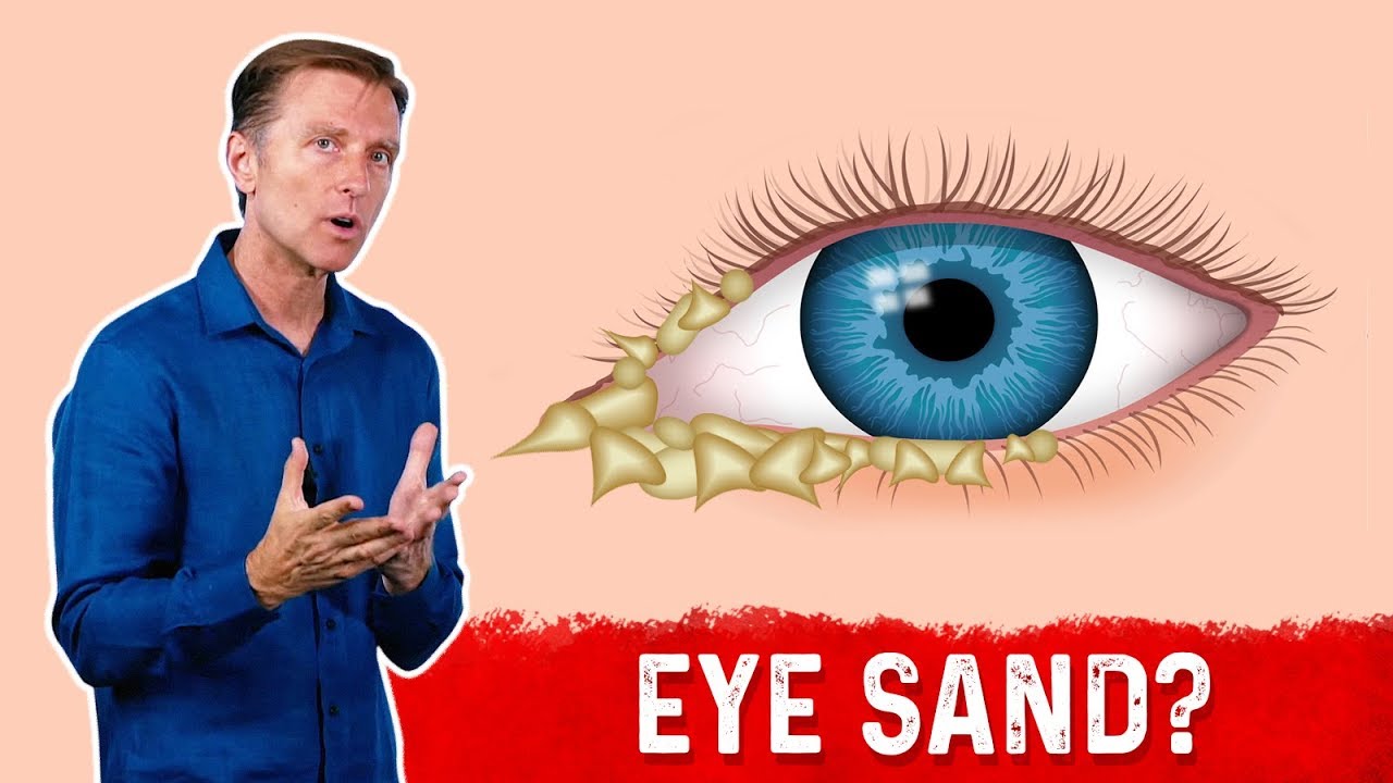 What Causes Crusty Eyes/ Eye Boogers? – Dr.Berg - YouTube