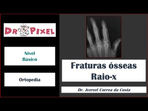 Fraturas ósseas ao raio-x