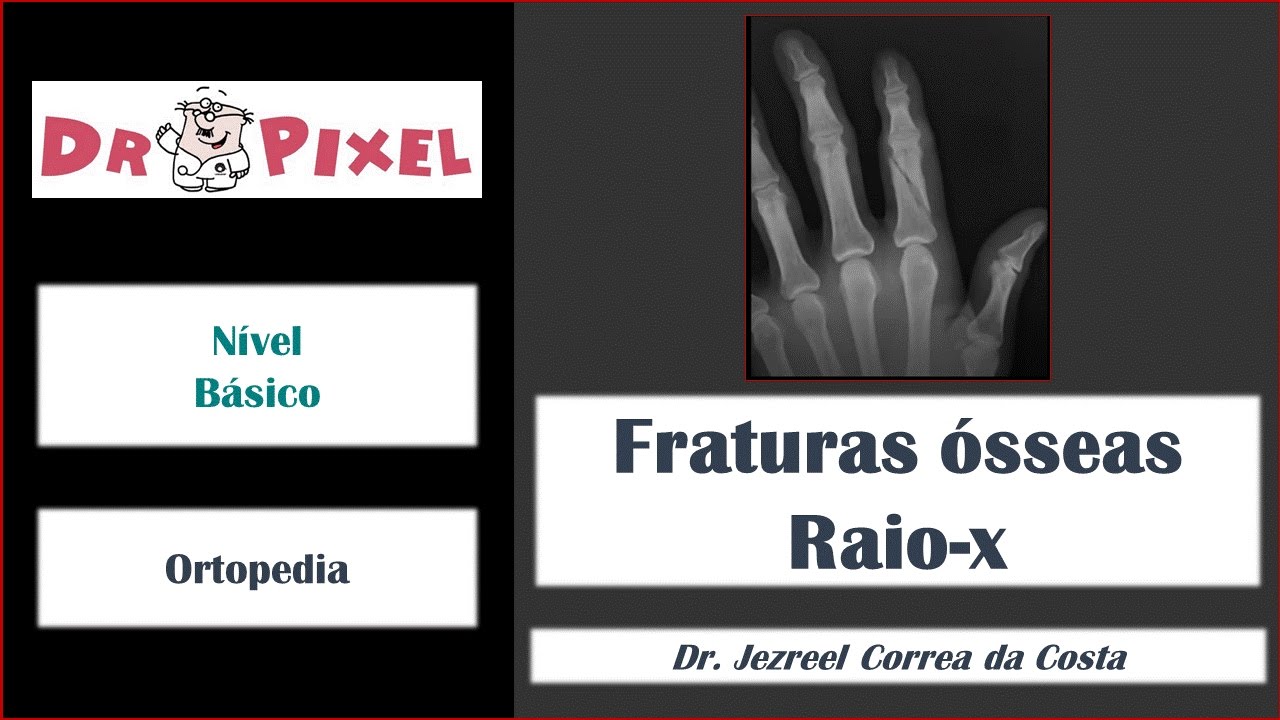 Fraturas ósseas ao raio-x