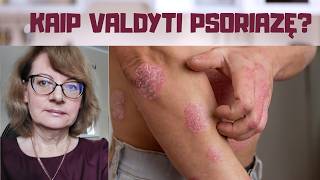 Psoriazė (žvynelinė): kodėl ji atsiranda ir kaip ją valdyti? Mityba, hormonai ir kinų medicina