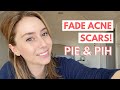 How To Fade Acne Scars Post Inflammatory Erythema Post Inflammatory Hyperpigmentation