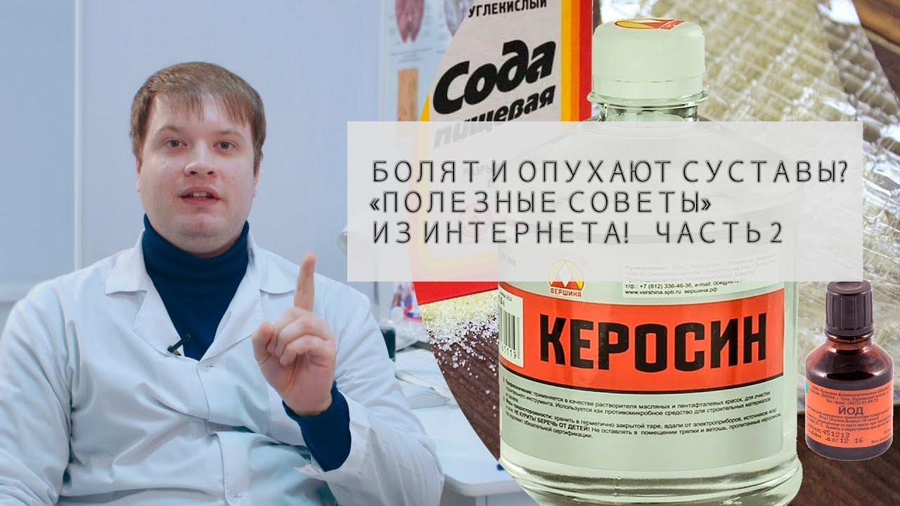 Болят и опухают суставы | Средства для наружного применения |Полезные советы из интернета ЧАСТЬ 2