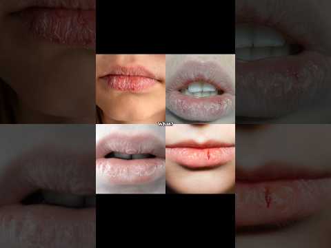 Chapped Lips Solution That Works | Best Lip Care Products You Need #shorts #lipcare #nivea #selfcare