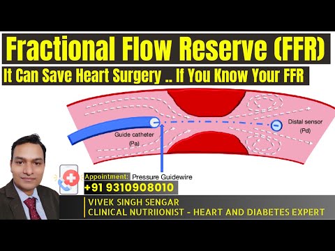 Do You Know Fractional Flow Reserve (FFR) in Cardiology .. !! Save Heart Surgery Know Your FFR