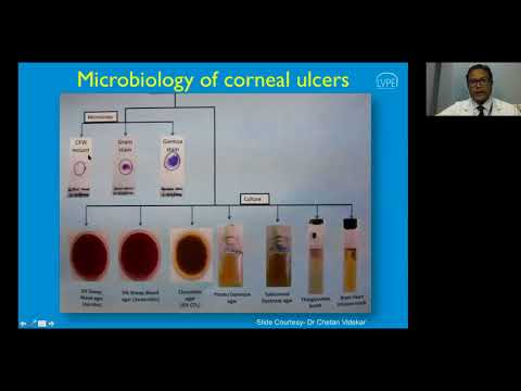 Evaluation of Corneal Ulcers