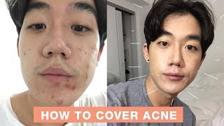 HOW TO COVER ACNE WITH MAKEUP: 5 STEPS | Brute Choi