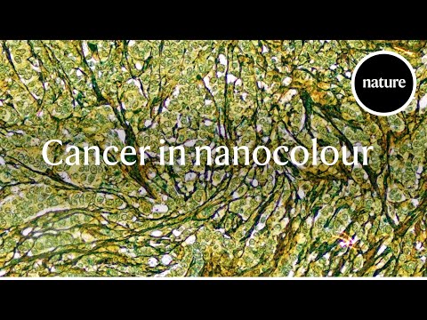 image-What does microscopic cancer cells mean? 